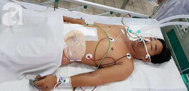 Người đàn ông sống sót thần kỳ sau 27 ngày điều trị vì bị cưa máy cắt ngang bụng kinh hoàng-2