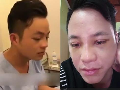 Lộ làn da xỉn, nhăn nheo của cô dâu 61 tuổi sau khi dao kéo khiến ai nấy giật mình vì tiếc tiền-7