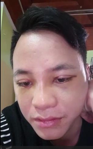 Nhấn mí nâng mũi mong bảnh trai hơn, không ngờ gương mặt chú rể 26 tuổi ở Cao Bằng khiến ai nhìn cũng lắc đầu-3