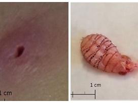 Rùng mình cảnh bác sĩ bắt kiến kiếm ăn trong… tai bệnh nhân-2