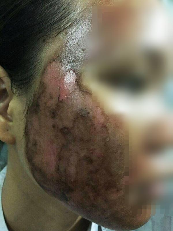 Góc cảnh báo: Cứ thích lăn kim, lột da nữa đi, bạn sẽ mất mặt như chơi đó!-3