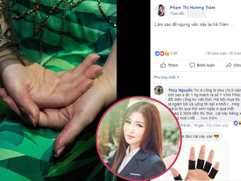 Hương Tràm stress, bóc da tay vì phải hủy show để tập trung luyện hát-3