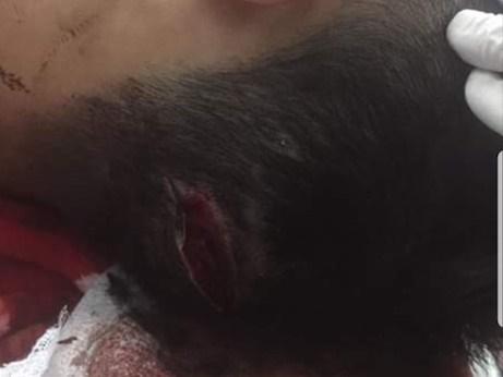 Thanh Hóa: Côn đồ xông vào nhà truy sát hai anh em-2