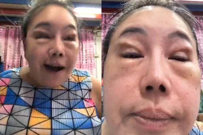 Thêm loạt ảnh gây shock của nữ đại gia yêu 28 lần/ ngày sau tuyên bố sẽ đẹp như gái 30 khi chi đống tiền thẩm mỹ-3