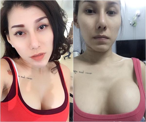 Đau như sống trong địa ngục nhưng ca sĩ bị nổ túi ngực Ivy Trần một mực không đến bệnh viện vì kinh tế kiệt quệ-2