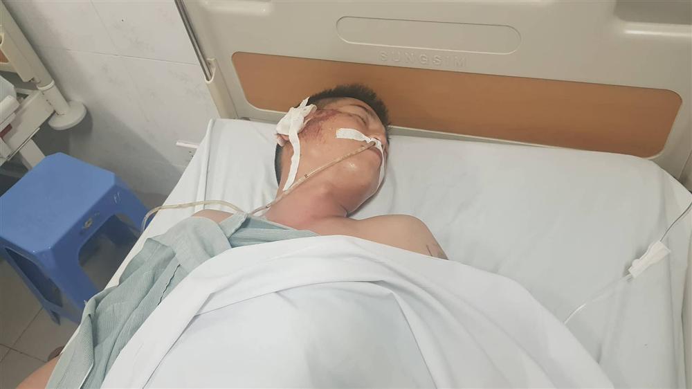 Vợ tài xế taxi kể khoảnh khắc chồng bị xe Mazda chèn qua người-3