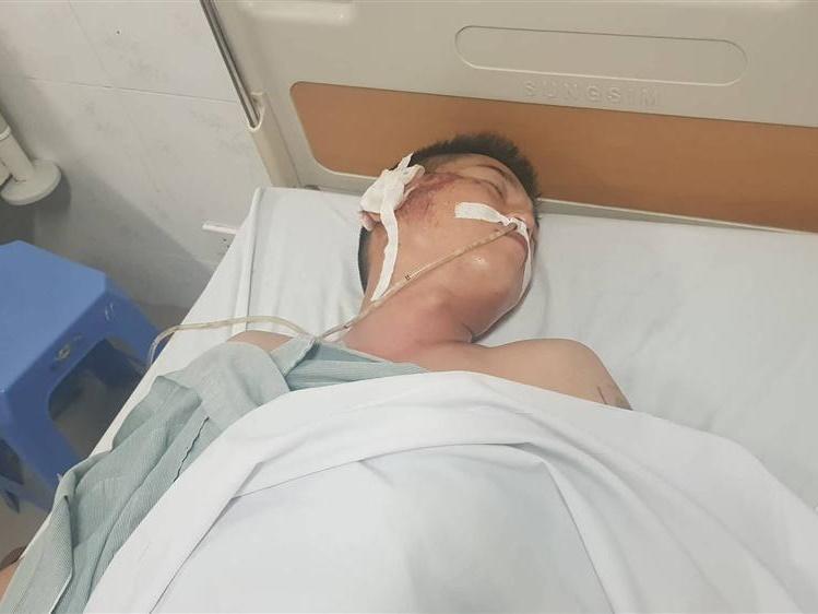 Kẻ bắn tài xế taxi rồi chèn xe Mazda qua người có 9 tiền án, tiền sự-2