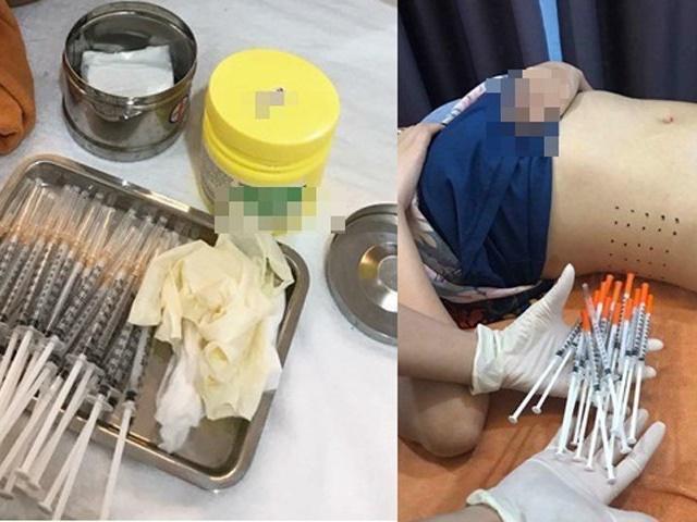 Nôn nóng giảm cân, cô gái uống cả lít nước tương đã bị chết não-3