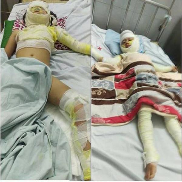 Bố nướng mực gây cháy lớn, con 2 tuổi tử vong, vợ bỏng nặng-1