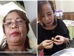Tiêm mỡ trẻ hóa da chưa đủ, cô dâu 61 tuổi ở Cao Bằng vừa tiếp tục chi thêm 200 triệu làm nguyên hàm răng sứ-3