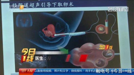 Sự thật đáng sợ phía sau dịch vụ mua bán trứng của các cô gái trẻ-4