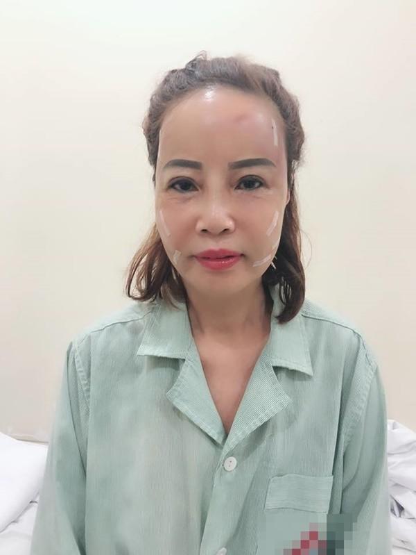 Khoe răng sáng lóa sau khi đầu tư 200 triệu, cô dâu 61 tuổi hôn chồng trẻ tóp má khi livestream khiến người xem ngán ngẩm-3