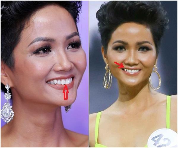 Trước ngày chinh chiến Miss Universe 2018, HHen Niê sung sướng khoe hàm răng khểnh nay đã đều tăm tắp-2