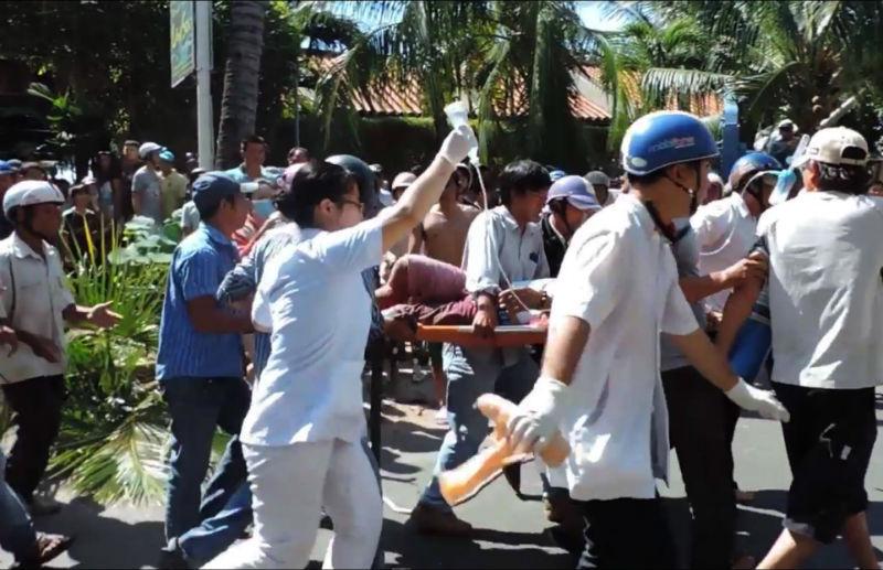 Xe ben lao vào resort tông 2 xe jeep, đè nát chân người dân-4