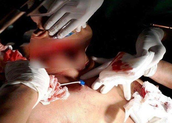 Nối ruột cứu sống người đàn ông bị đâm 10 nhát dao-1