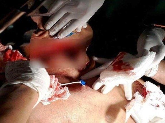 Vụ cuồng ghen ở Củ Chi: Hung thủ ra tay tàn độc với em vợ-2