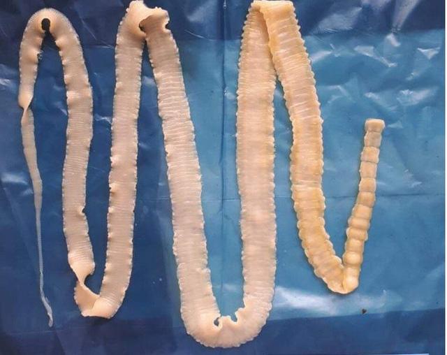 Giật mình cảnh sán dây rơi khi làm thịt lợn thả rông, hàng loạt người nhiễm bệnh-5