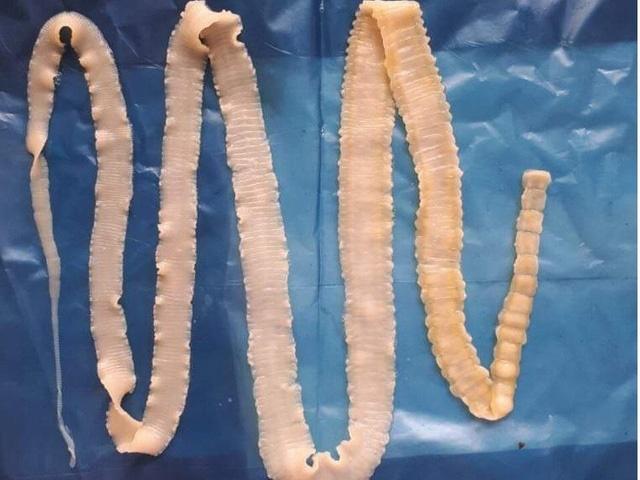 Phụ huynh vây trường mầm non, yêu cầu xác minh tin đồ ăn nghi có sán-2