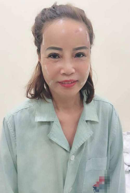 Cô dâu 62 tuổi và nhan sắc mới tân trang có thể giữ lâu dài?-5