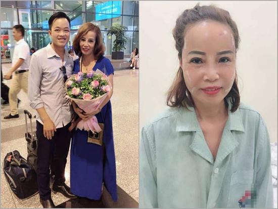 Cô dâu 62 tuổi và nhan sắc mới tân trang có thể giữ lâu dài?