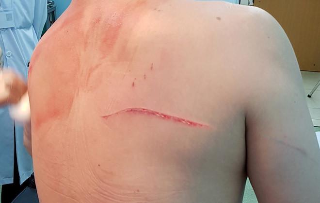 Đề nghị truy tố 6 người tham gia chém bác sĩ Chiêm Quốc Thái-1