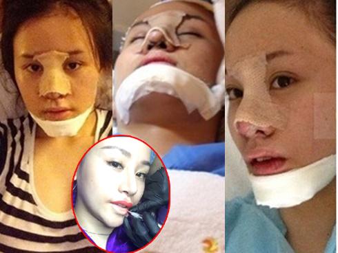 Sửa nát ngực - đập mặt xây lại, giờ đôi môi bà Tưng cũng không còn là 'của nhà làm ra' nữa rồi