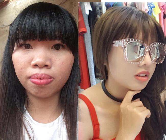 8 ca thẩm mỹ của chị em Việt gây bão dư luận vì biến gái xấu thành tiên-3