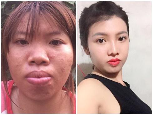 8 ca thẩm mỹ của chị em Việt gây bão dư luận vì biến 'gái xấu thành tiên'