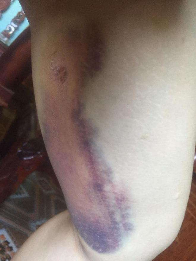 Bị đồn gương mặt biến dạng sau 2 năm thẩm mỹ, Thị Nở tái sinh bất ngờ lên tiếng-5