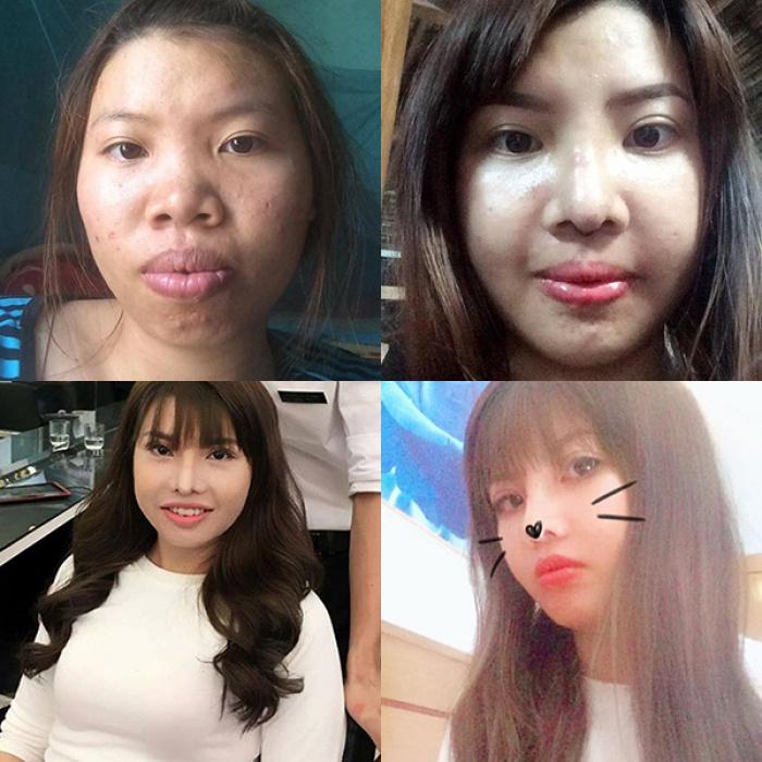 Bị đồn gương mặt biến dạng sau 2 năm thẩm mỹ, Thị Nở tái sinh bất ngờ lên tiếng-1