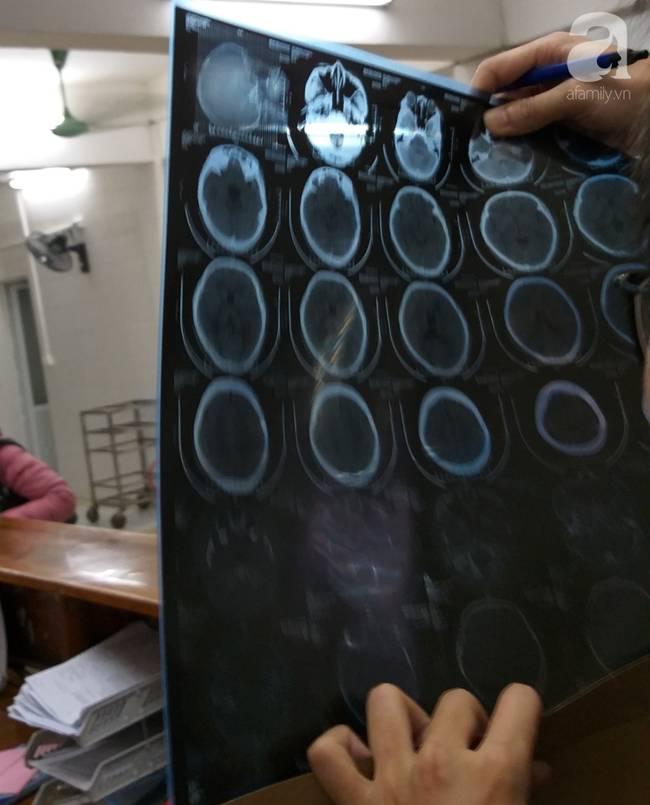 Nữ sinh lớp 9 ở Hà Nội tố bị vợ hai của bố đập đầu, đánh tới mức phải nhập viện-3