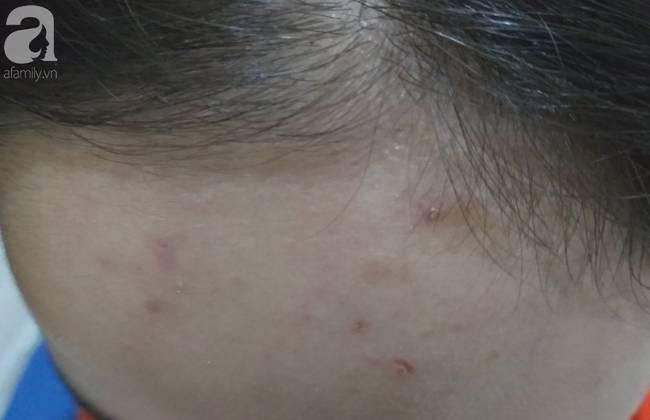 Nữ sinh lớp 9 ở Hà Nội tố bị vợ hai của bố đập đầu, đánh tới mức phải nhập viện-6