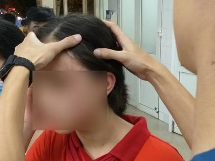Nữ sinh lớp 9 ở Hà Nội tố bị vợ hai của bố đập đầu, đánh tới mức phải nhập viện