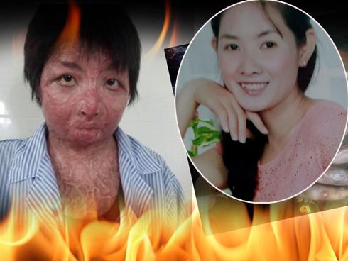 Hé lộ nhan sắc và cuộc sống hiện tại của cô gái trẻ bị chồng tẩm xăng thiêu sống gây chấn động một thời ở Hưng Yên