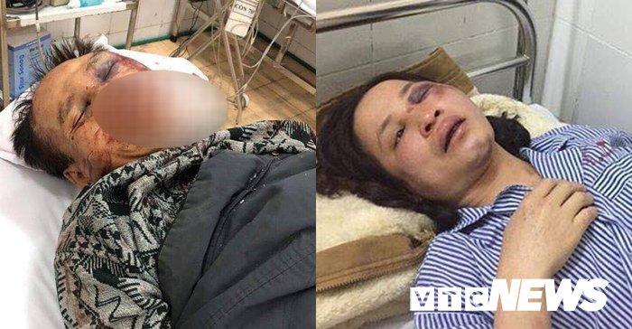 Huynh đệ tương tàn ở Vân Đồn, luật sư: Kết luận điều tra có dấu hiệu bỏ lọt tội phạm-2