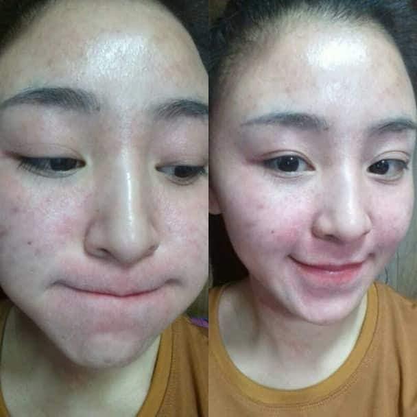 Gây shock khi để lộ gương mặt chi chít mụn, hotgirl bánh tráng thừa nhận bị kem trộn bức hại-3
