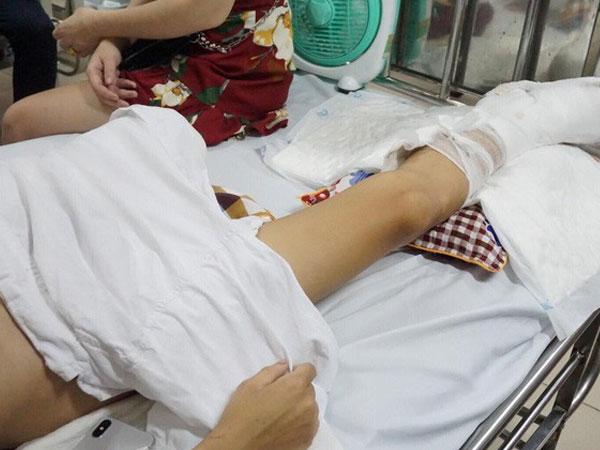 Kẻ cầm đầu nhóm côn đồ truy sát khiến nam thanh niên phải cưa chân khai gì?-2