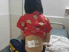 Phú Yên: Công an xác nhận cô gái trúng đạn từ súng cao su của CSGT