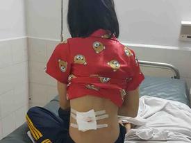 Phú Yên: Công an xác nhận cô gái trúng đạn từ súng cao su của CSGT Phú Yên: Công an xác nhận cô gái trúng đạn từ súng cao su của CSGT