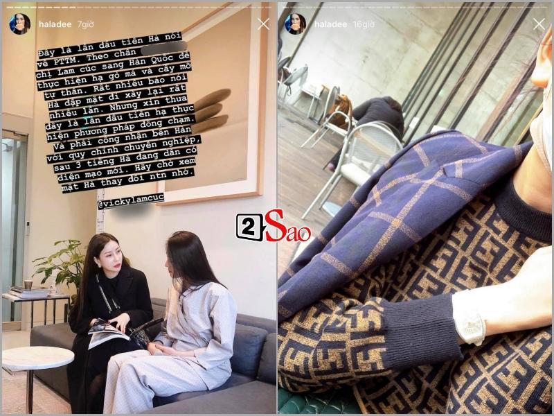 Sau trăm lần phủ nhận dao kéo dù mặt cứng đơ như tượng, Hà Lade thú thật phẫu thuật thẩm mỹ lần đầu tiên-6