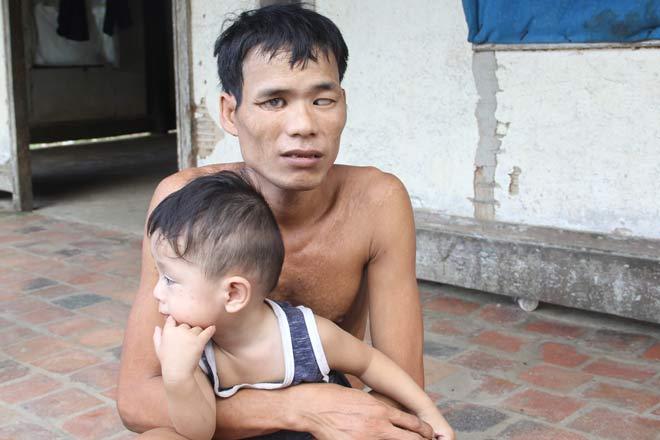 Cảm động chuyện tình rổ rá giữa cô nàng chân voi và anh chàng mù-3