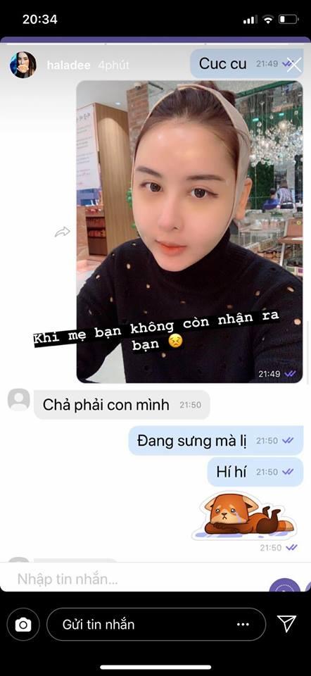 Chi 12.000 USD phẫu thuật thẩm mỹ, tới mẹ Hà Lade cũng không nhận ra con gái-1