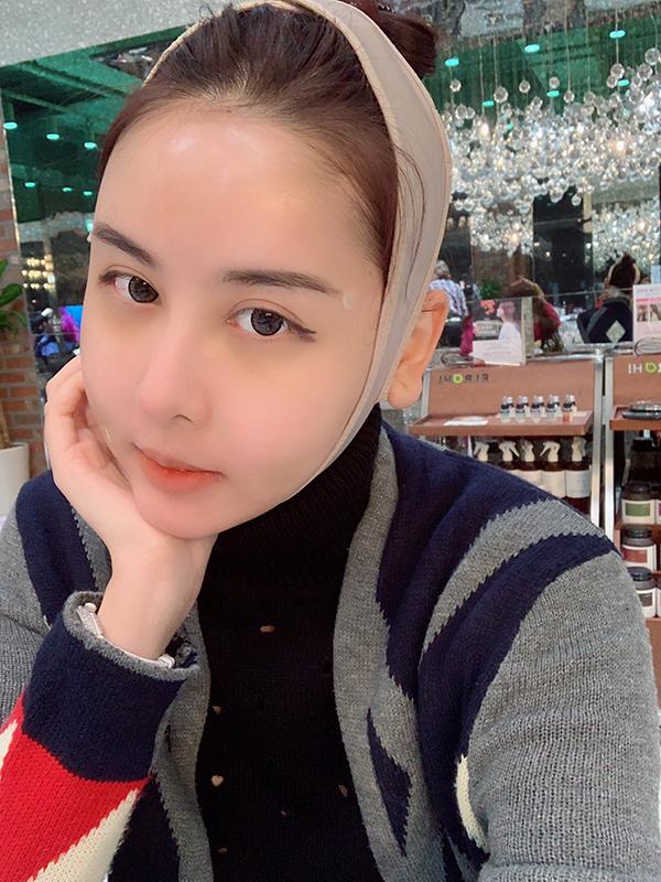 Chi 12.000 USD phẫu thuật thẩm mỹ, tới mẹ Hà Lade cũng không nhận ra con gái-3