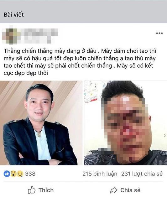 Danh hài Chiến Thắng bị tố thuê vệ sĩ đánh đập khán giả chảy máu mặt?-1