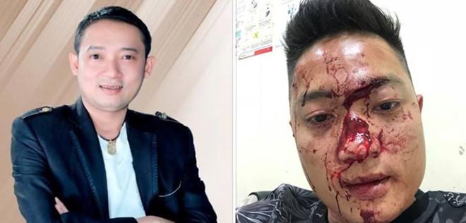 Danh hài Chiến Thắng bị tố thuê vệ sĩ đánh đập khán giả chảy máu mặt?-3