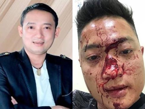 Danh hài Chiến Thắng tiết lộ chuyện từng bị fan nữ gạ tình một đêm-4