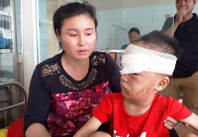 Thanh Hóa: Kinh hoàng bé trai 6 tuổi bị chó nhà cắn rách mặt-1