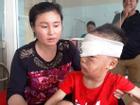 Thanh Hóa: Kinh hoàng bé trai 6 tuổi bị chó nhà cắn rách mặt