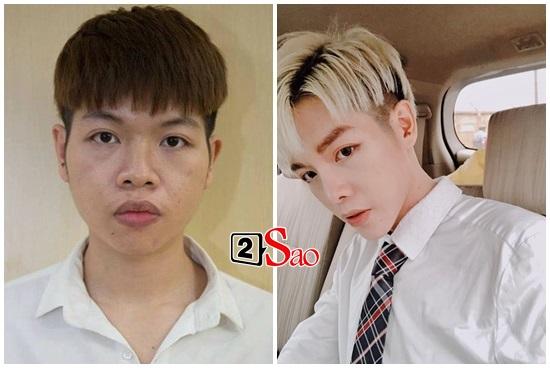 Đâu chỉ mỹ nhân thích làm đẹp, sao nam cũng chạy đua trào lưu cằm nhọn Vline nhìn ai cũng giống nhau-6