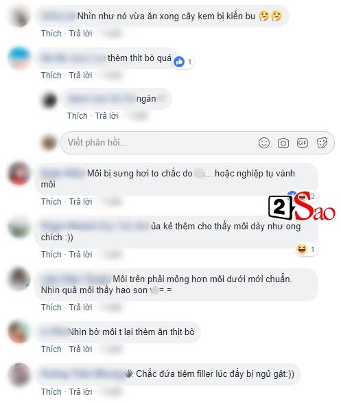 Môi đã dày, Thiên Nga The Face còn biến thành nỗi ám ảnh với người khác với cách tô son đậm đáng sợ-2